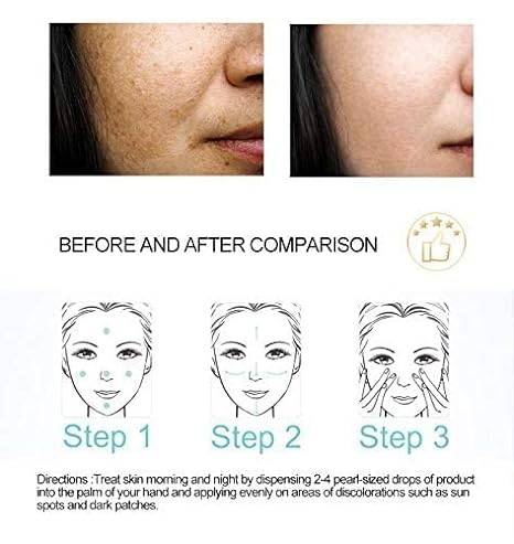 DR.RASHEL WHITE SKIN Whitening Fade Spots Serum 50ml Spotless, Radiant Skin — serum on white background