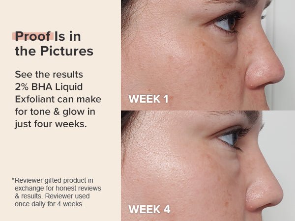 PAULA'S CHOICE Skin Perfecting 2% BHA Liquid Exfoliant Reveal Smoother, Clearer Skin — beauty product on white background