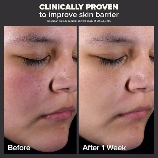 PAULA'S CHOICE Skin Perfecting 2% BHA Liquid Exfoliant Reveal Smoother, Clearer Skin β beauty product on white background