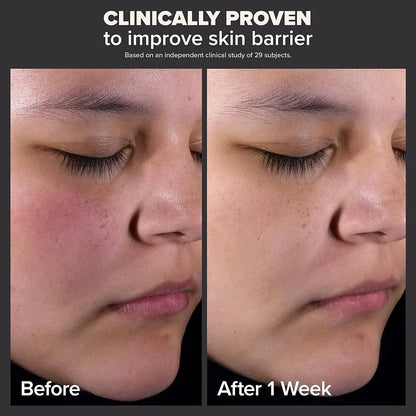 PAULA'S CHOICE Skin Perfecting 2% BHA Liquid Exfoliant Reveal Smoother, Clearer Skin — beauty product on white background